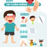 TP Hồ Chí Minh: Đỉnh dịch tay chân miệng sẽ trùng với thời gian học sinh tựu trường