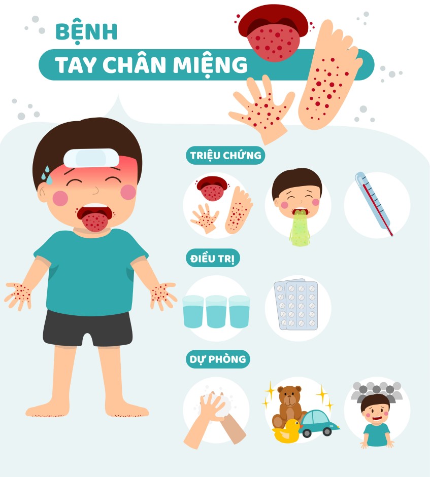 TP Hồ Chí Minh: Đỉnh dịch tay chân miệng sẽ trùng với thời gian học sinh tựu trường